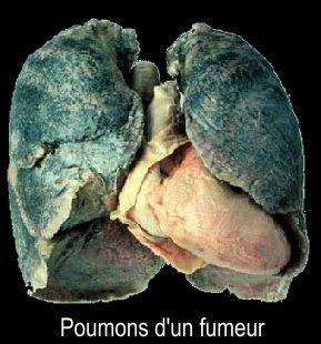 Cigarettes : Prix augmenté de 6%